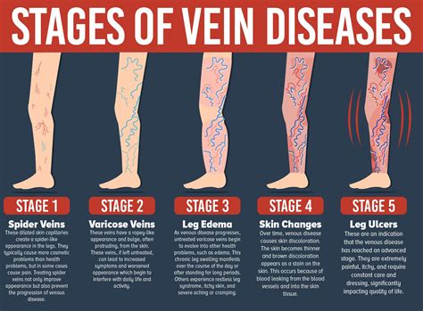 vein hard after blood test|vein rolling when touched.